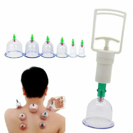 12 Pcs Hijama Cupping Kit
